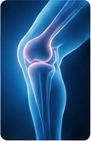 Medical illustration of a knee joint